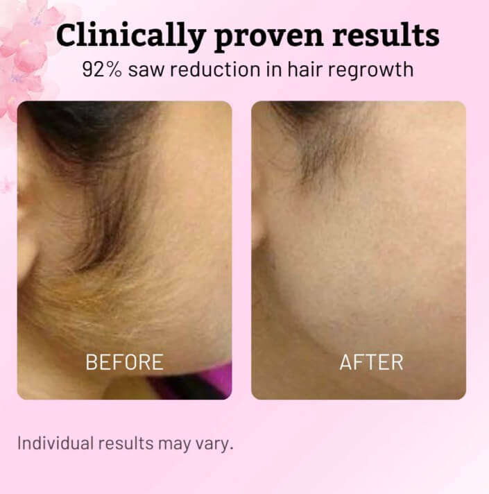 Cyperus Rotundus Oil