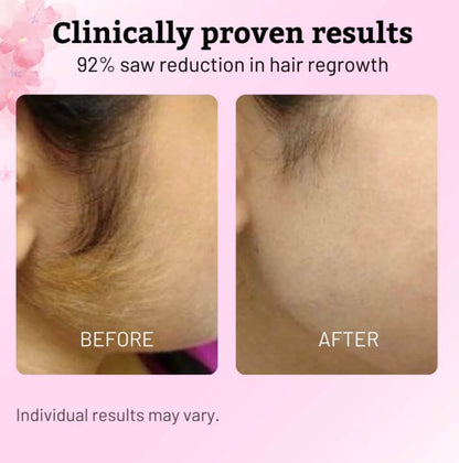 Cyperus Rotundus Oil